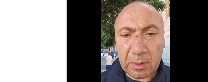 Оппозиция зовет вечером на масштабный митинг на площади Республики в Ереване 