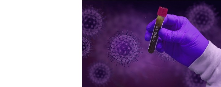 Число инфицированных коронавирусом в Армении достигло 532