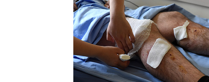 ԱՆ. հիվանդանոցներում բուժումը շարունակում է Երևանի ՊՊԾ գնդի մոտակայքում անկարգություններից տուժած 17 անձ