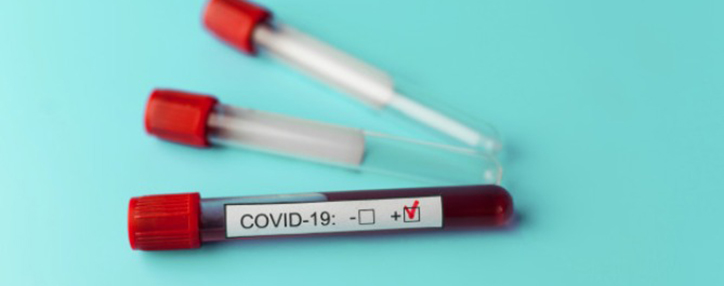  Число жертв коронавируса в Армении выросло до четырех - Минздрав