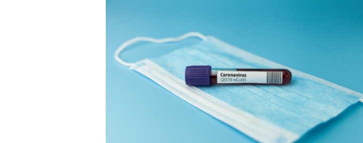 Минздрав сообщил о первом случае смерти от коронавируса в Армении